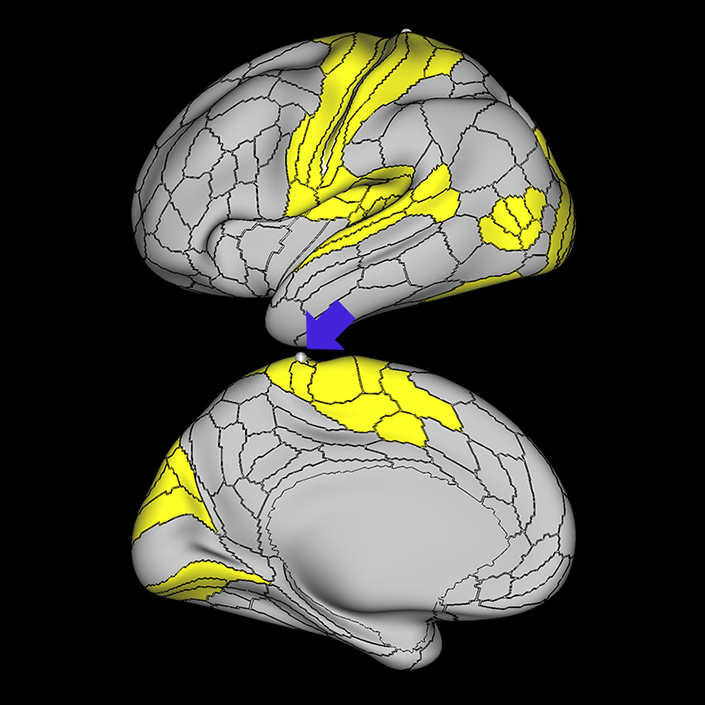 3b_a