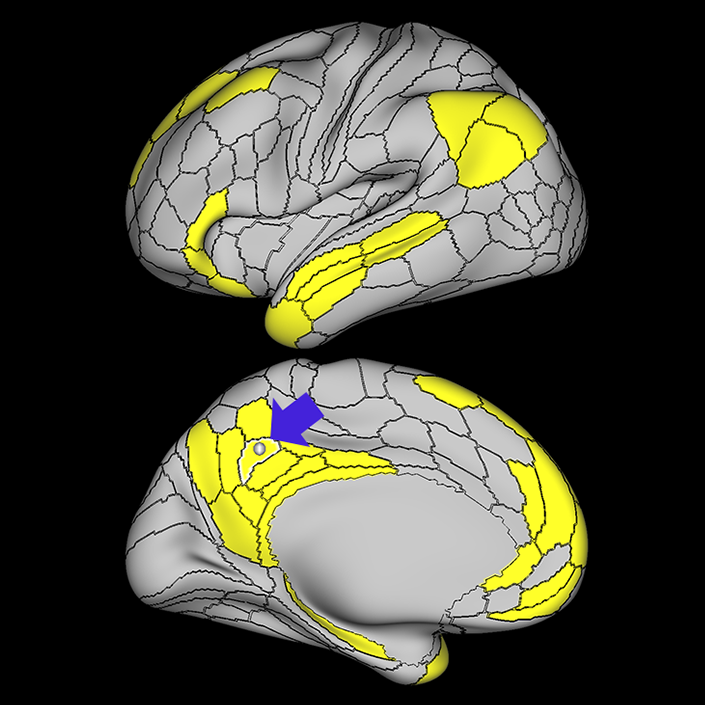31pd_a
