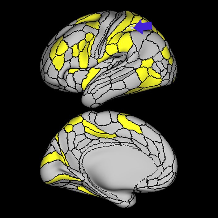 AIP_a