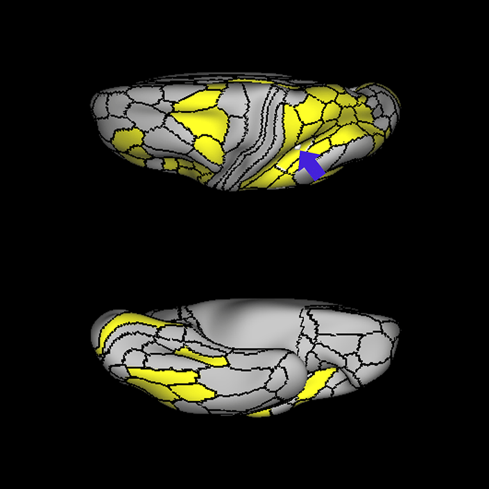 AIP_c