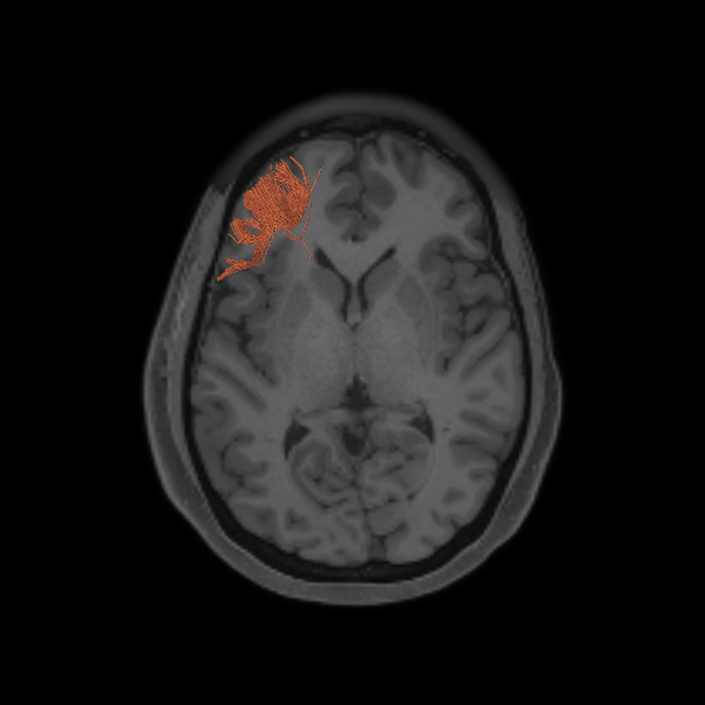 a9-46v_dti