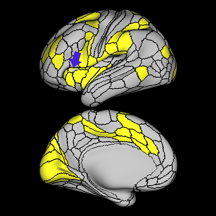 FOP4_a