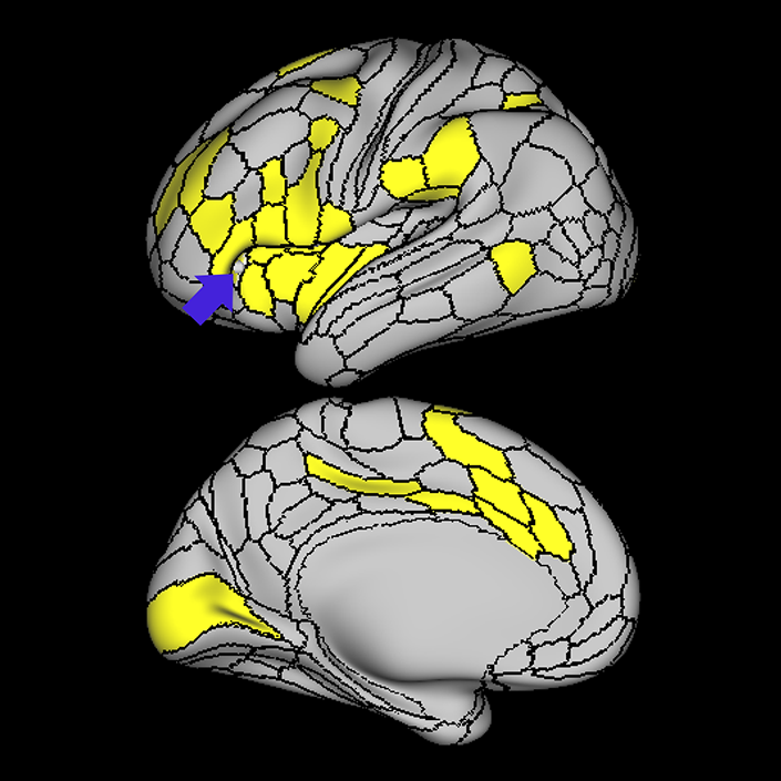 FOP5_a