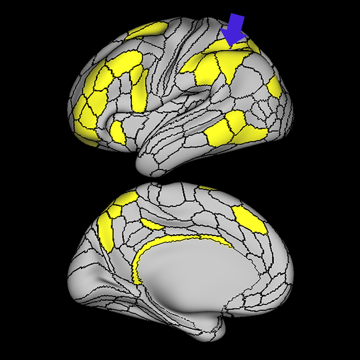 IP2_a