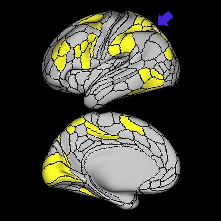 MIP_a