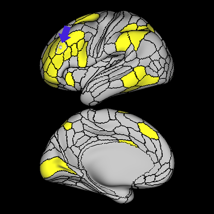 p9-46v_a