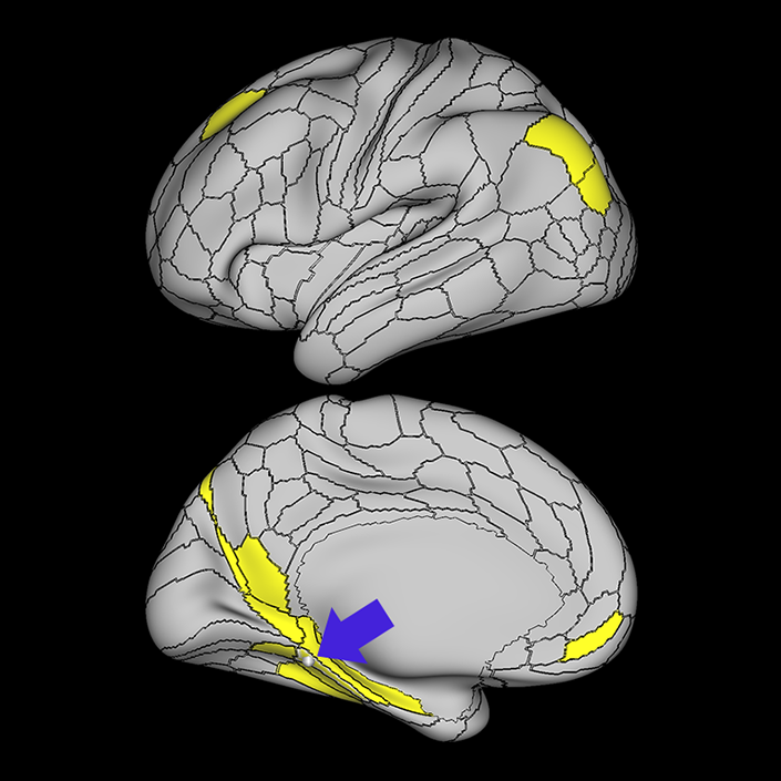 PHA1_a