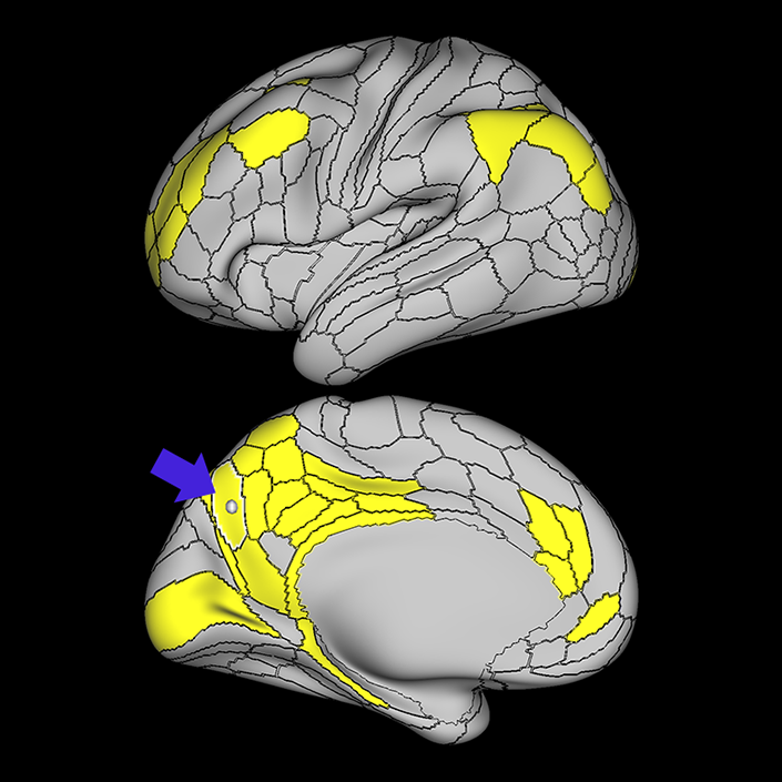 POS1_a