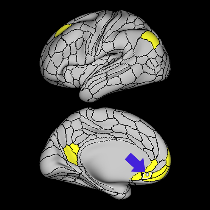 s32_a