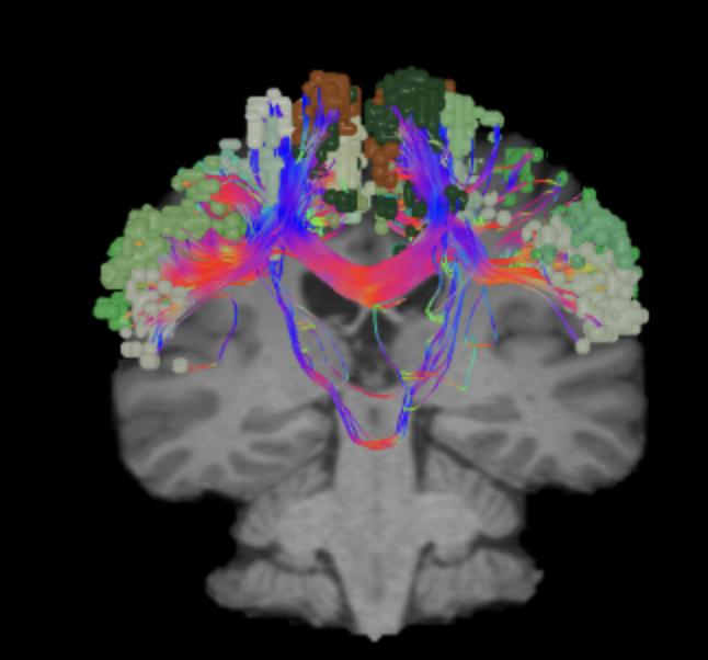 sensorimotor_cor